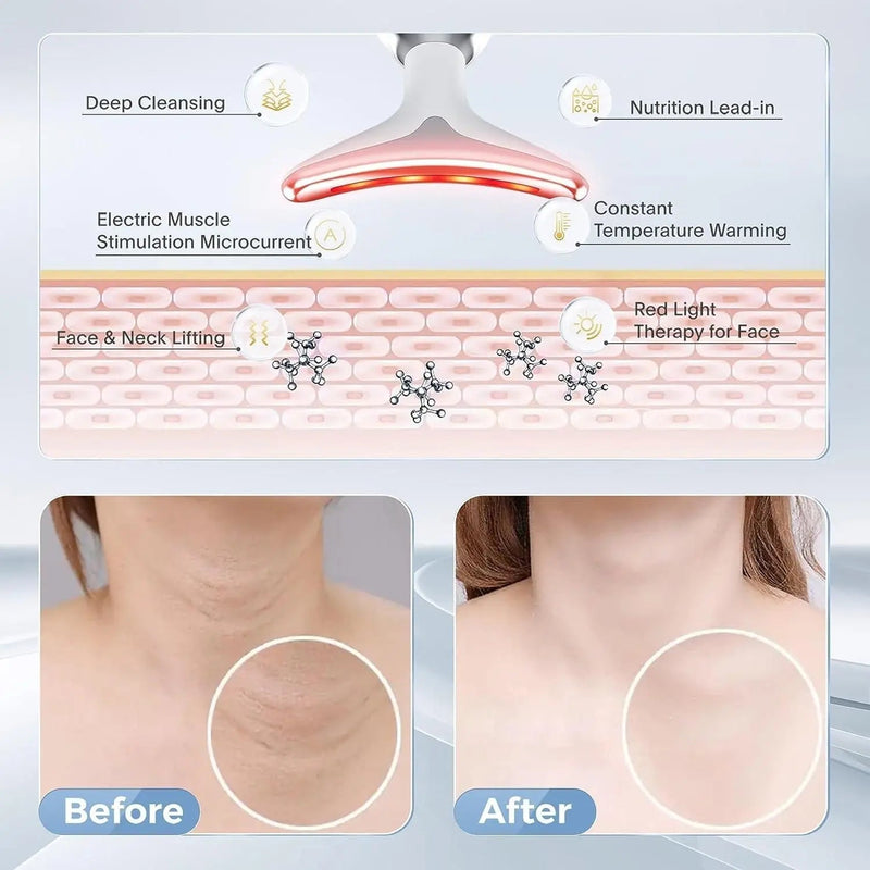 Skin Lifting & Firming Facial Massager – Beauty Device