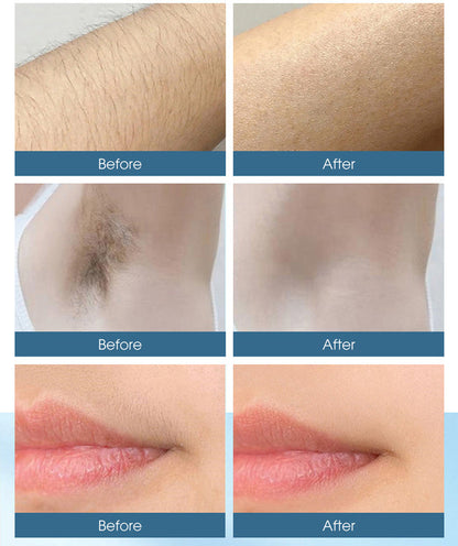 IPL Permanent Laser Hair Removal Machine